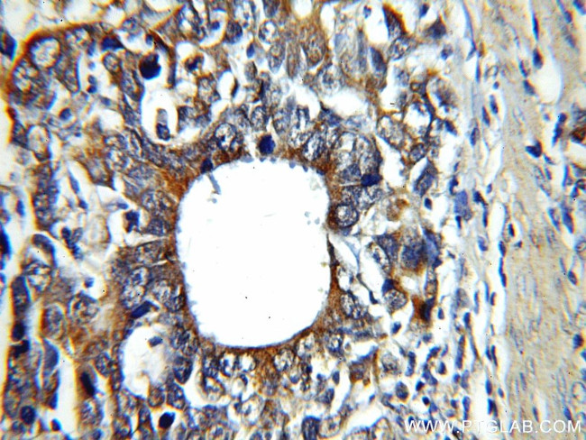 CAPG Antibody in Immunohistochemistry (Paraffin) (IHC (P))