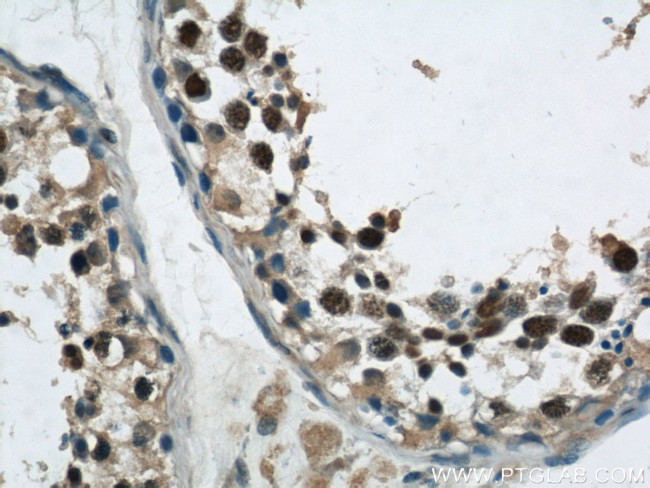 Phospho-FANCD2 (Ser330) Antibody in Immunohistochemistry (Paraffin) (IHC (P))