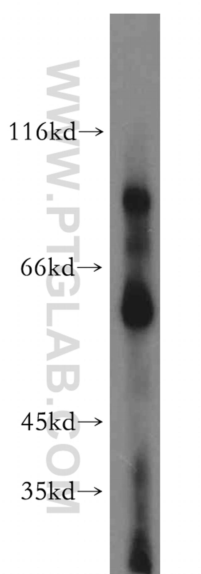 LPIN2 Antibody in Western Blot (WB)