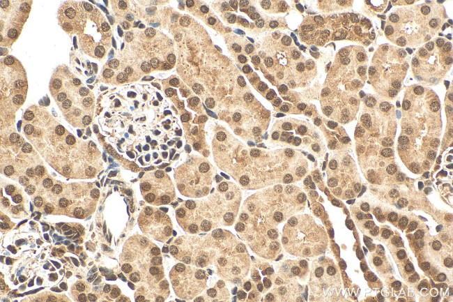 RGC32 Antibody in Immunohistochemistry (Paraffin) (IHC (P))