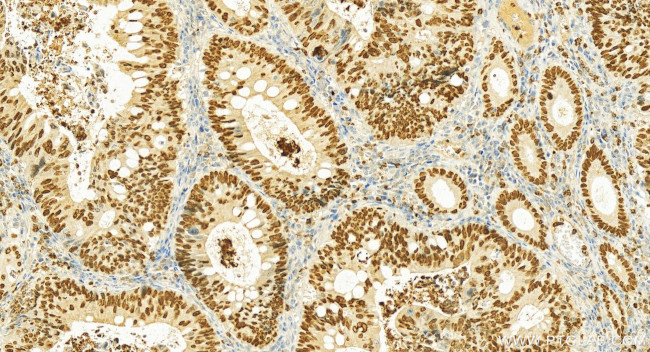 SATB2 Antibody in Immunohistochemistry (Paraffin) (IHC (P))