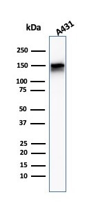EGFR (Epidermal Growth Factor Receptor) Antibody in Western Blot (WB)