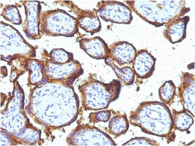 EGFR (Epidermal Growth Factor Receptor) Antibody in Immunohistochemistry (Paraffin) (IHC (P))