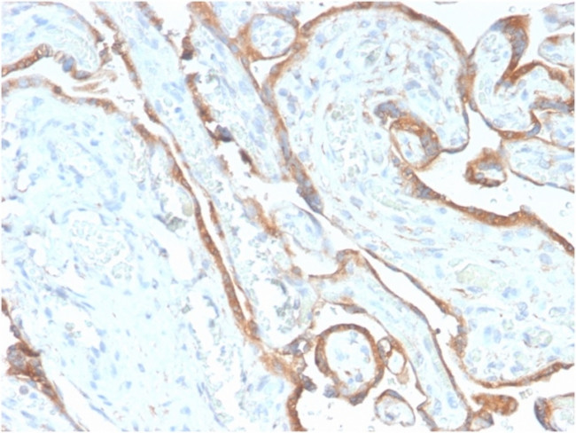 EGFR (Epidermal Growth Factor Receptor) Antibody in Immunohistochemistry (Paraffin) (IHC (P))