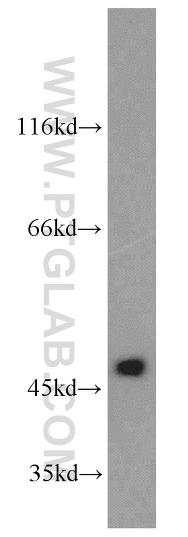 Phospho-SPHK1 (Ser225) Antibody in Western Blot (WB)
