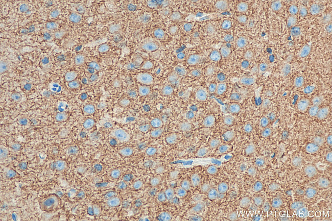 KCC2/SLC12A5 Antibody in Immunohistochemistry (Paraffin) (IHC (P))