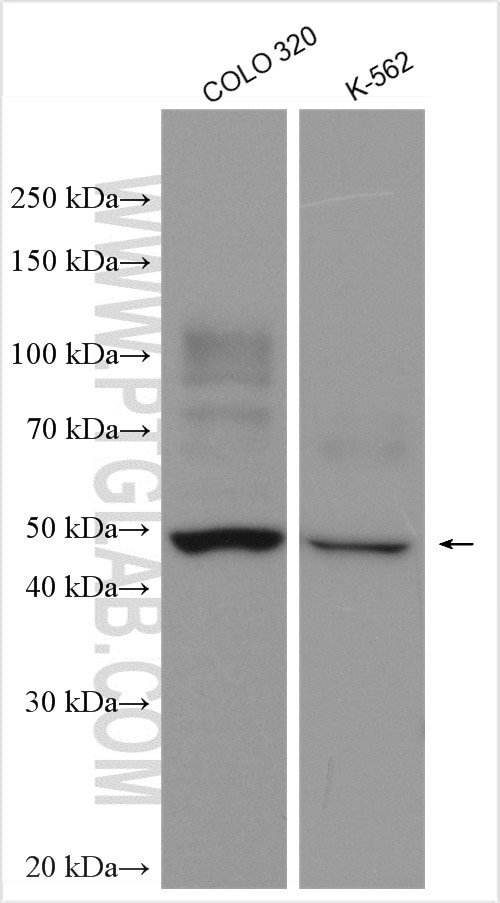 KIAA0494 Antibody in Western Blot (WB)