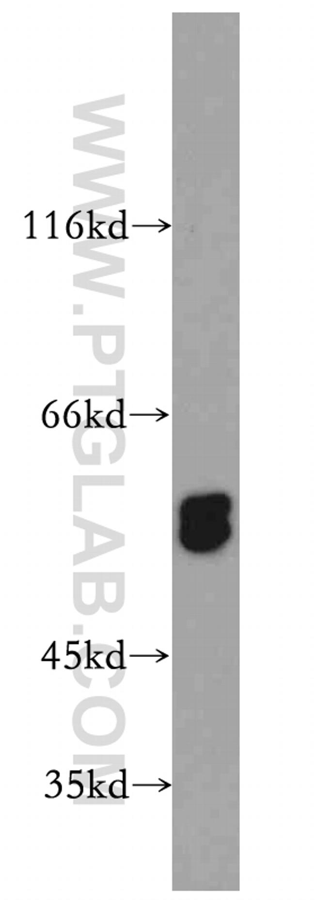 PPP3CC Antibody in Western Blot (WB)