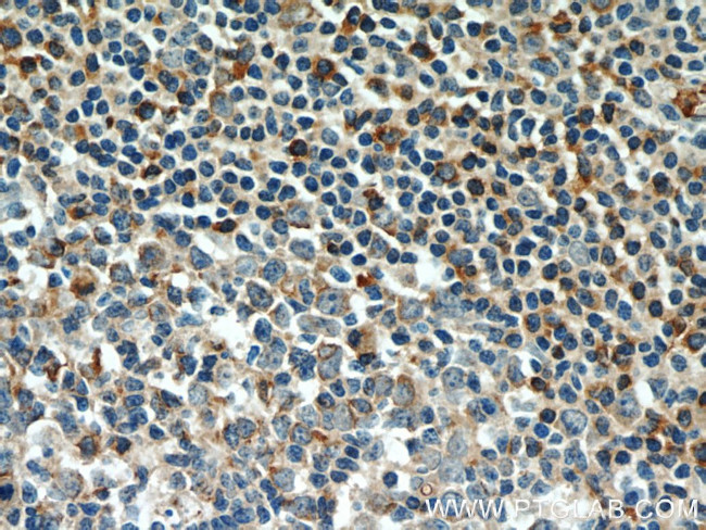 Integrin alpha-4 Antibody in Immunohistochemistry (Paraffin) (IHC (P))