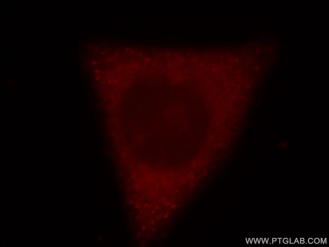 RRM1 Antibody in Immunocytochemistry (ICC/IF)