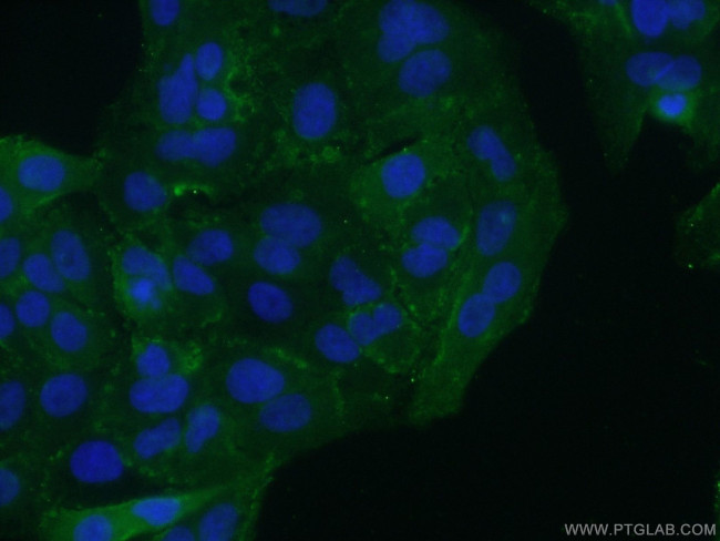 Integrin beta-6 Antibody in Immunocytochemistry (ICC/IF)