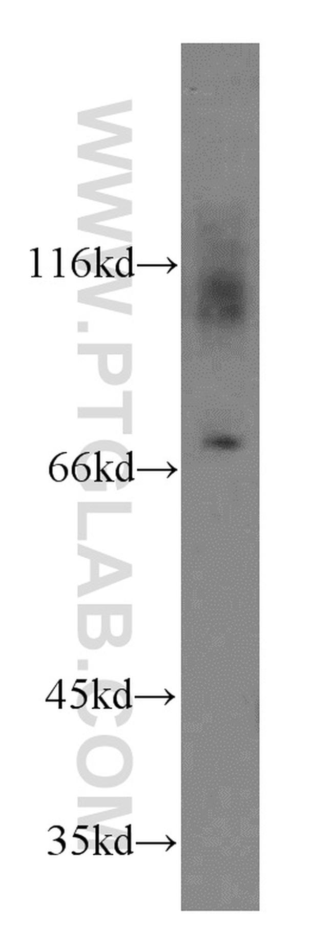 Kv1.4 Antibody in Western Blot (WB)