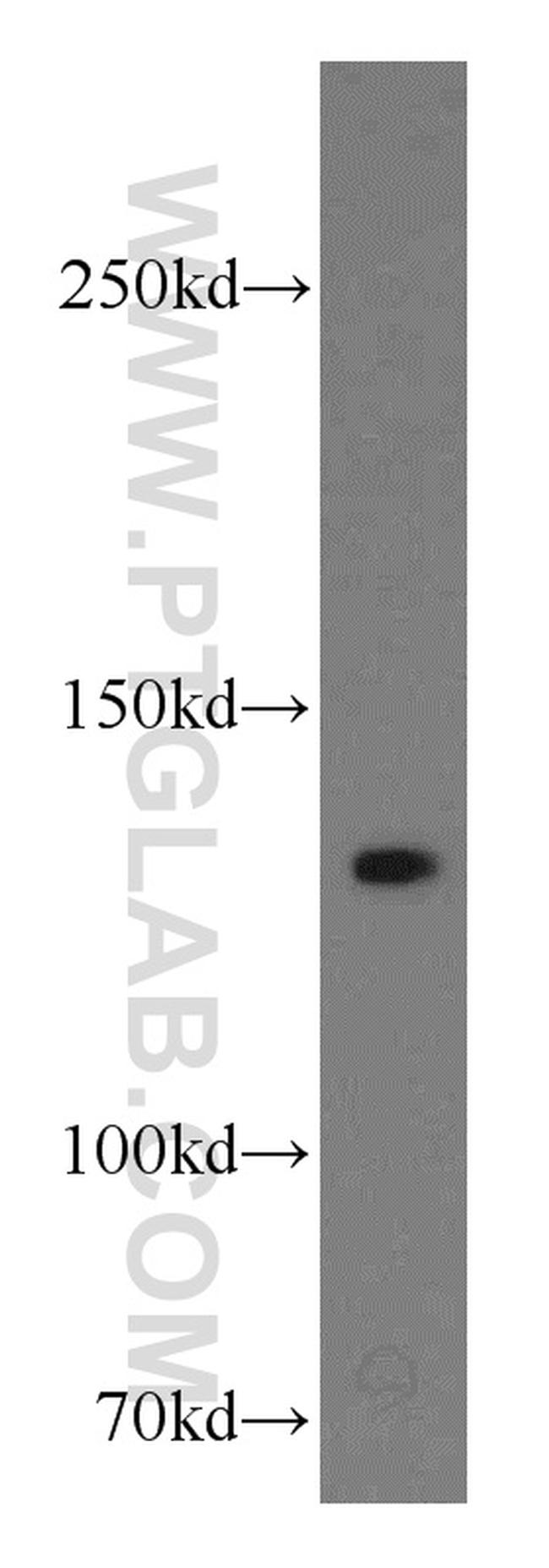 LAMC2 Antibody in Western Blot (WB)
