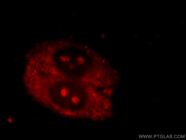 ND1 Antibody in Immunocytochemistry (ICC/IF)