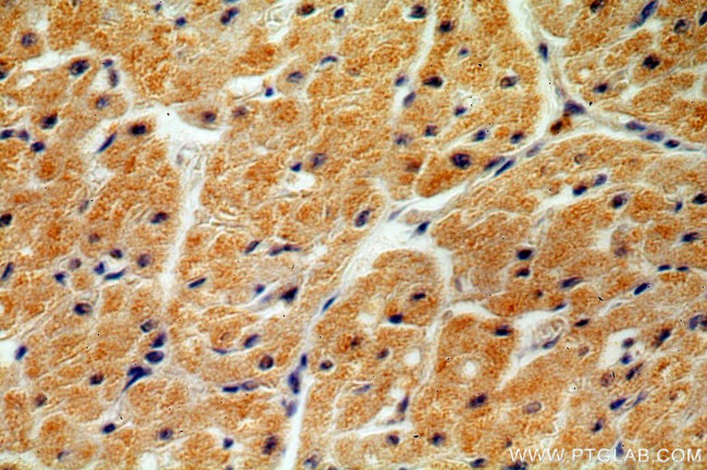 ND2 Antibody in Immunohistochemistry (Paraffin) (IHC (P))