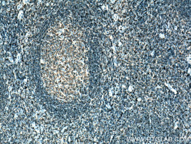 PTPRCAP / CD45AP Antibody in Immunohistochemistry (Paraffin) (IHC (P))