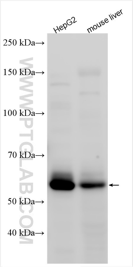 SNTB1 Antibody in Western Blot (WB)