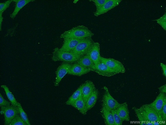 SPAG4 Antibody in Immunocytochemistry (ICC/IF)