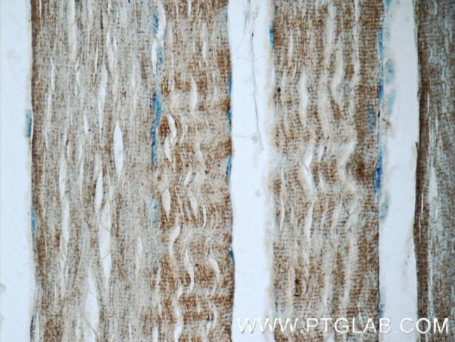 TNNT3 Antibody in Immunohistochemistry (Paraffin) (IHC (P))