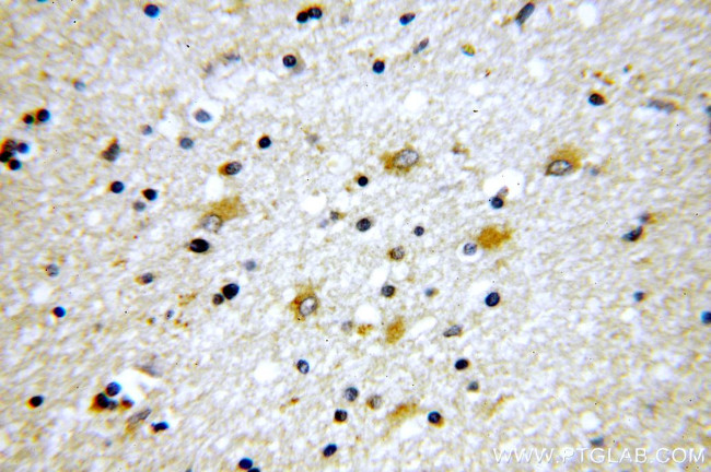 Tenascin-R Antibody in Immunohistochemistry (Paraffin) (IHC (P))