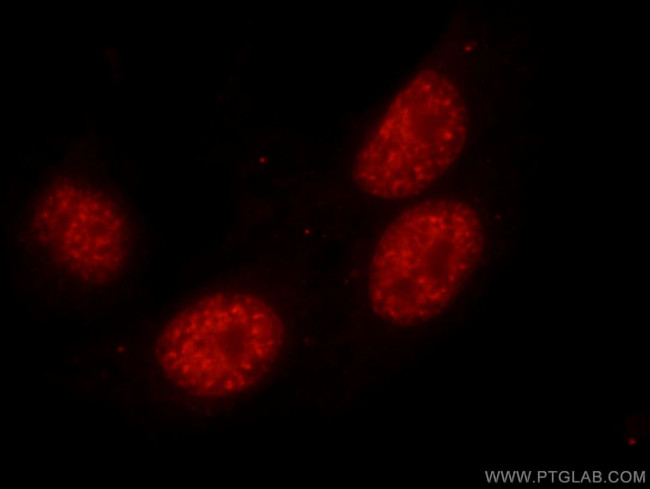 THRAP3 Antibody in Immunocytochemistry (ICC/IF)