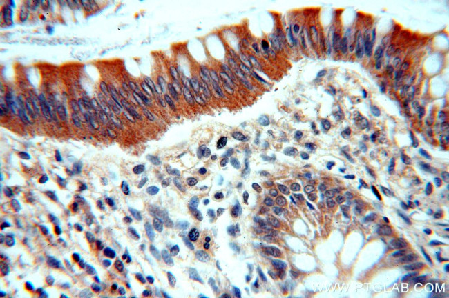 TINAG Antibody in Immunohistochemistry (Paraffin) (IHC (P))