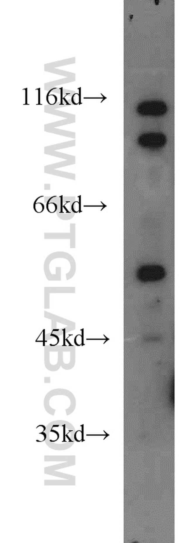 ARSK Antibody in Western Blot (WB)