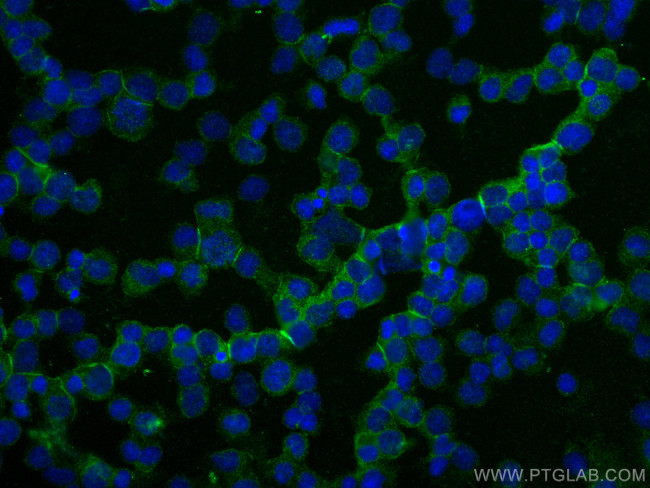 OR4K17 Antibody in Immunocytochemistry (ICC/IF)