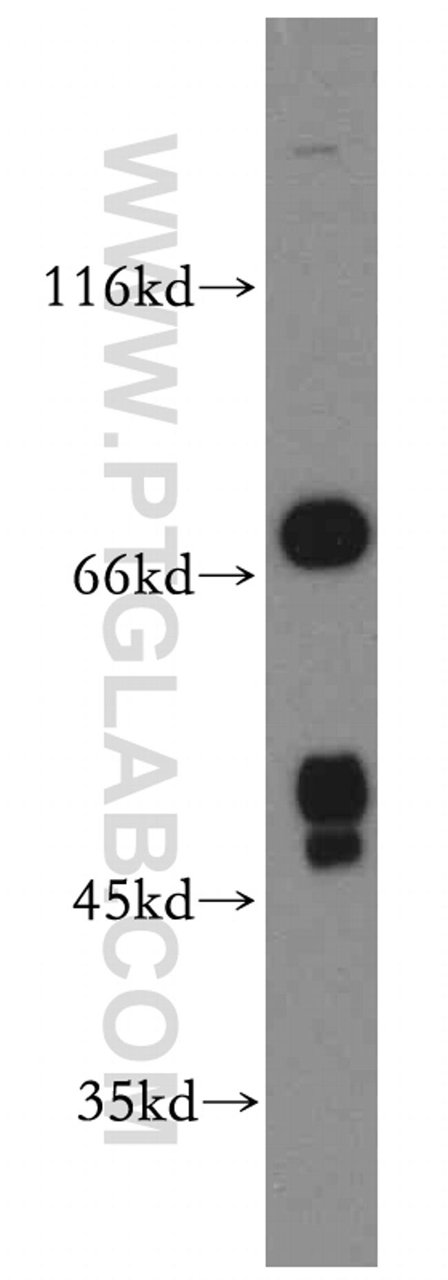 FOXJ3 Antibody in Western Blot (WB)