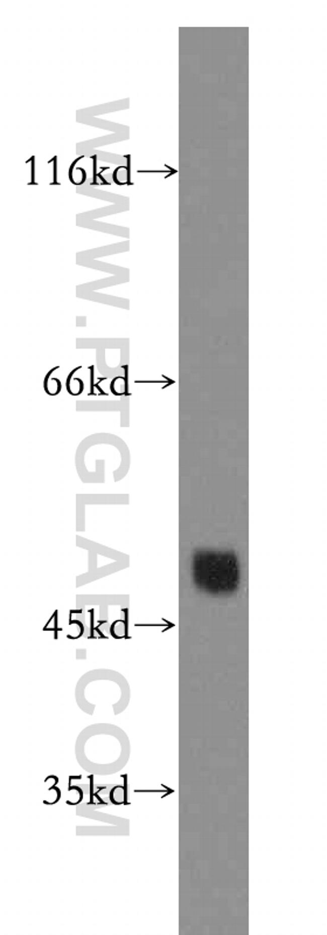 Connexin-46 Antibody in Western Blot (WB)