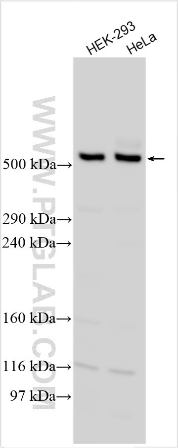 ABCA13 Antibody in Western Blot (WB)