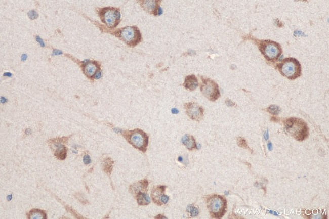 ADRA2B Antibody in Immunohistochemistry (Paraffin) (IHC (P))