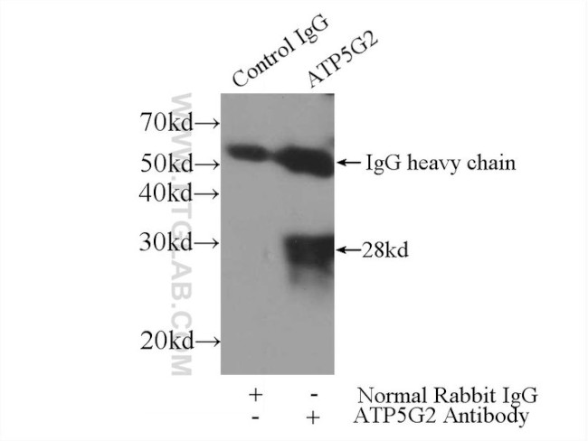 ATP5G2 Antibody in Immunoprecipitation (IP)