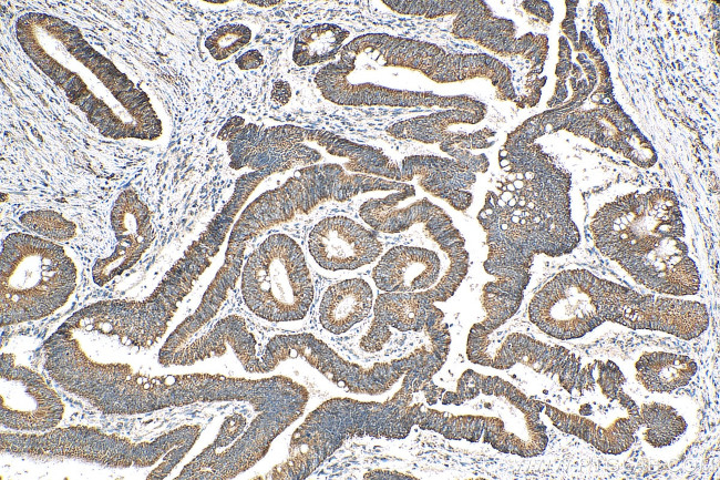 ATP7B Antibody in Immunohistochemistry (Paraffin) (IHC (P))