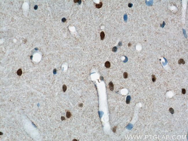 BRCA2 Antibody in Immunohistochemistry (Paraffin) (IHC (P))