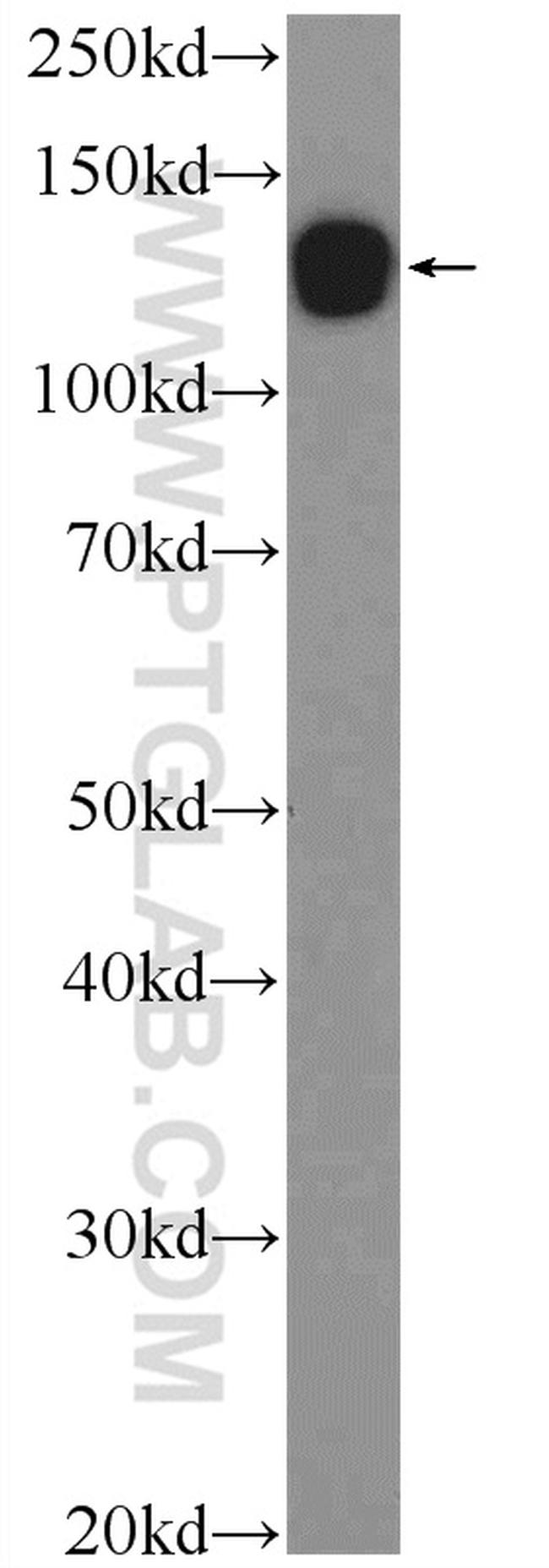 CDH10 Antibody in Western Blot (WB)
