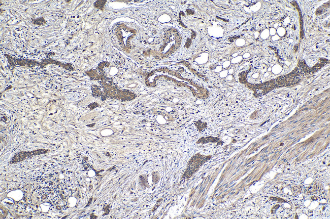 COL6A3 Antibody in Immunohistochemistry (Paraffin) (IHC (P))