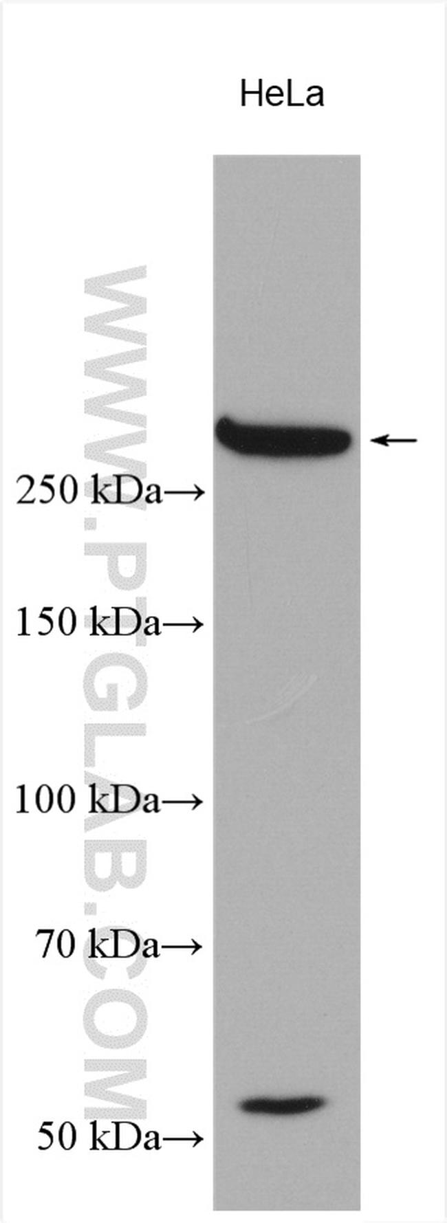 Collagen Type VII Antibody in Western Blot (WB)