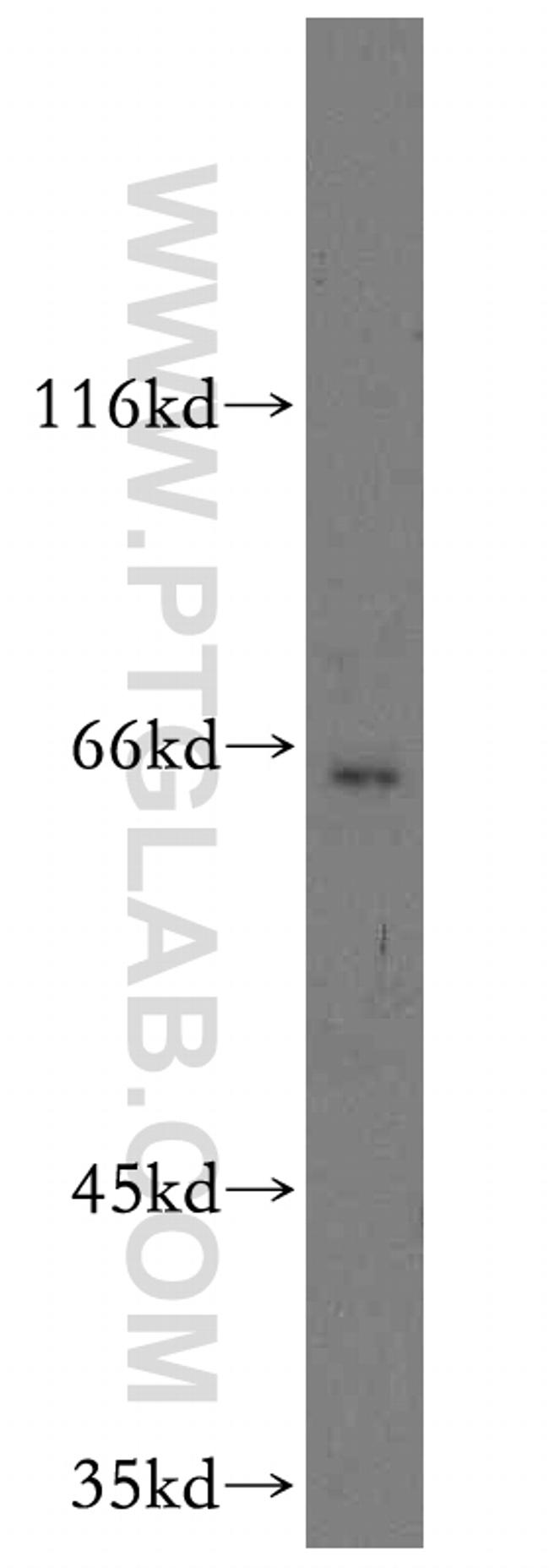 TM7SF3 Antibody in Western Blot (WB)
