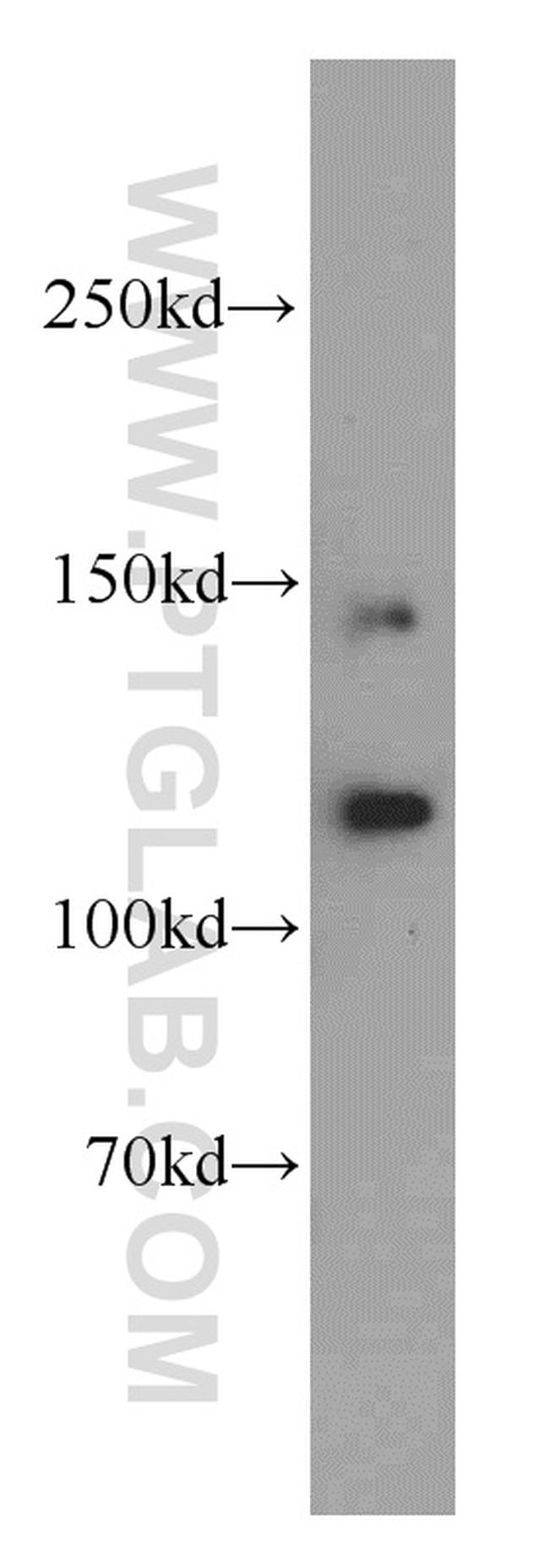 PLEKHG5 Antibody in Western Blot (WB)