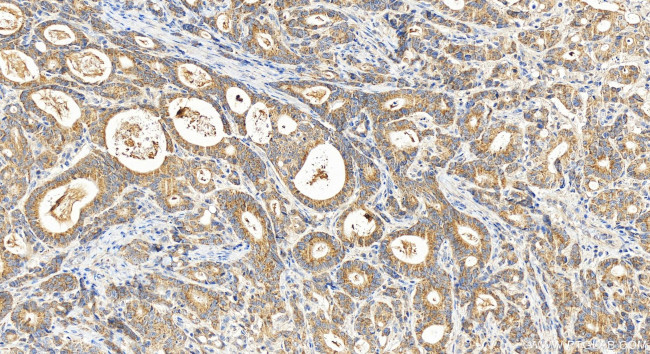 FUNDC2 Antibody in Immunohistochemistry (Paraffin) (IHC (P))