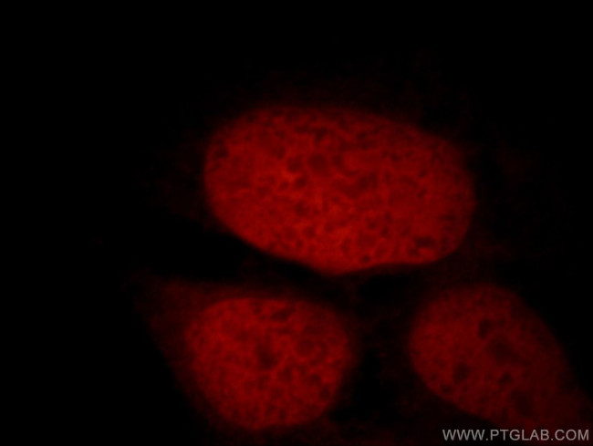 STAG2 Antibody in Immunocytochemistry (ICC/IF)