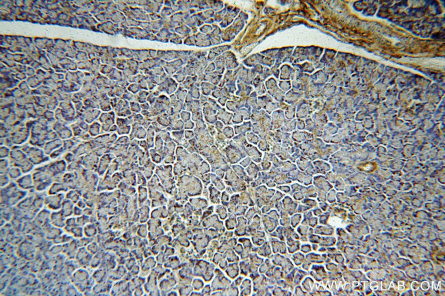 TMX2 Antibody in Immunohistochemistry (Paraffin) (IHC (P))