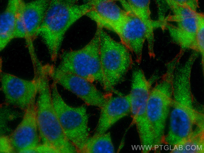CENPM Antibody in Immunocytochemistry (ICC/IF)