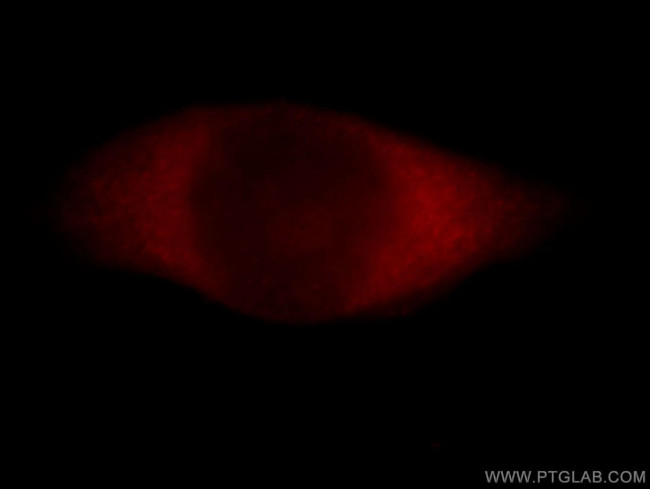 CALCOCO1 Antibody in Immunocytochemistry (ICC/IF)