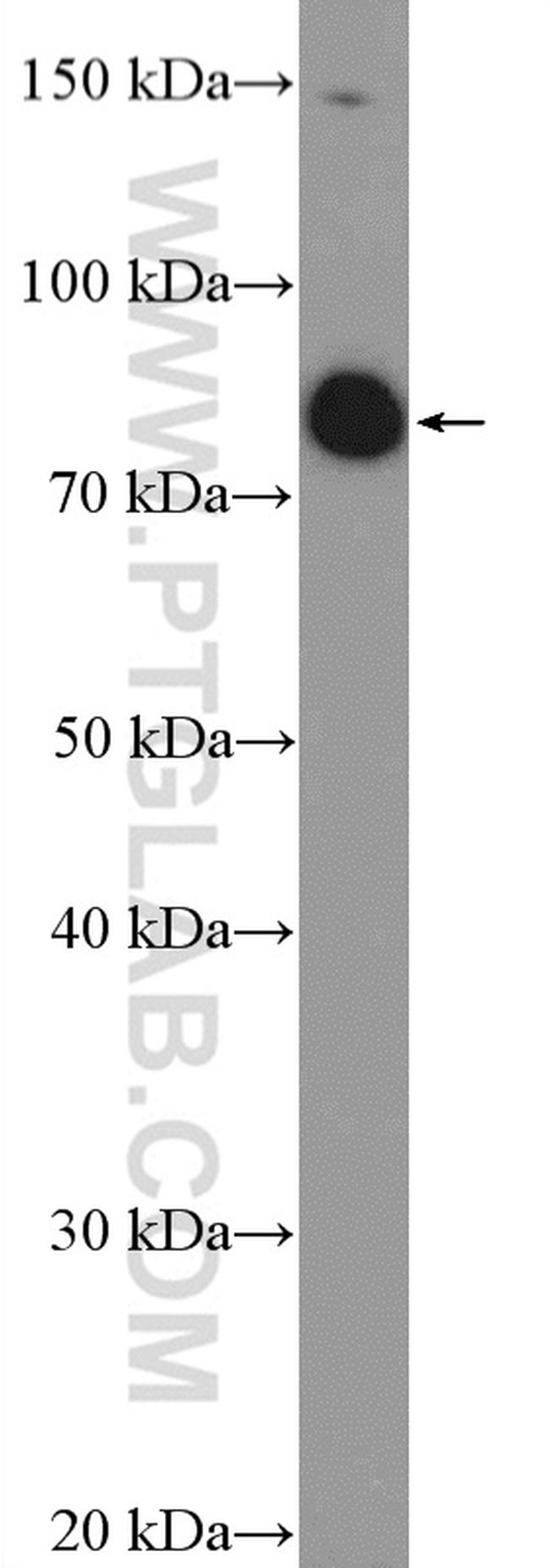 SP140L Antibody in Western Blot (WB)