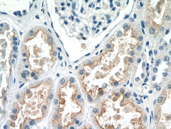 EFHD1 Antibody in Immunohistochemistry (Paraffin) (IHC (P))