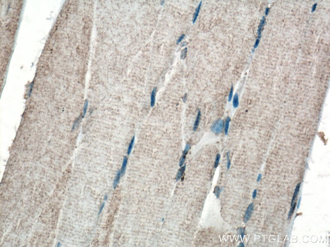 PHD2 Antibody in Immunohistochemistry (Paraffin) (IHC (P))