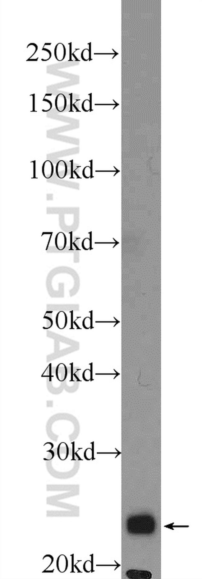 COX4NB Antibody in Western Blot (WB)