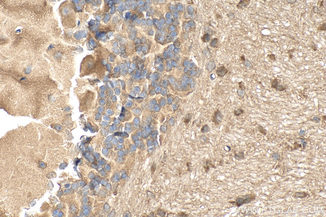 SNRNP25 Antibody in Immunohistochemistry (Paraffin) (IHC (P))